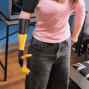 Budget-Friendly Forearm Prosthesis with Wrist & Hand – 3D Printable, Custom Fit, Easy Assembly